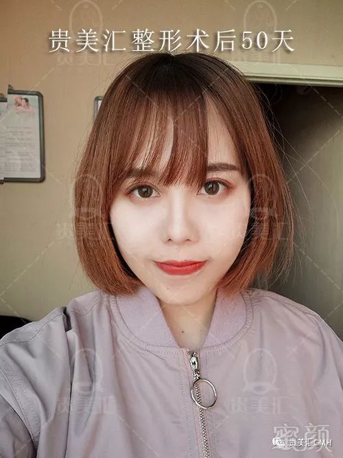 https://img.miyanlife.com/mnt/timg/180221/1133351551-15.jpg