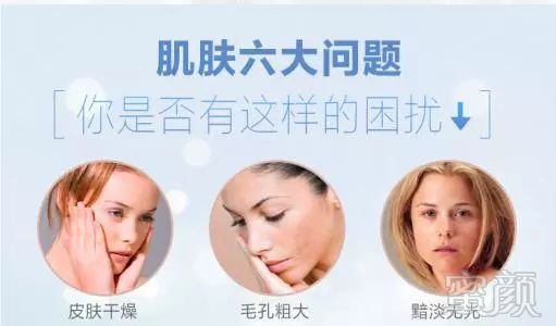 https://img.miyanlife.com/mnt/timg/180222/10392013L-2.jpg