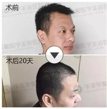 https://img.miyanlife.com/mnt/timg/180222/103AIO7-14.jpg