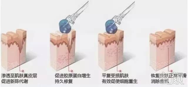 https://img.miyanlife.com/mnt/timg/180222/10401W211-6.jpg