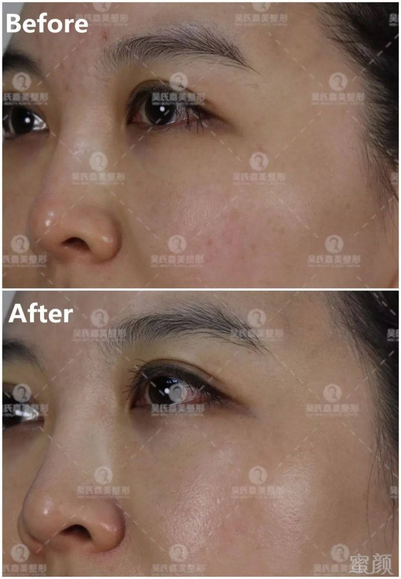 https://img.miyanlife.com/mnt/timg/180222/1040221648-10.jpg