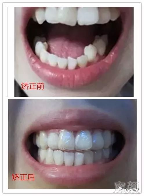 https://img.miyanlife.com/mnt/timg/180222/105T44163-5.jpg