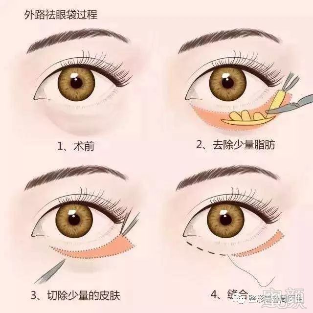 https://img.miyanlife.com/mnt/timg/180222/112KR150-3.jpg
