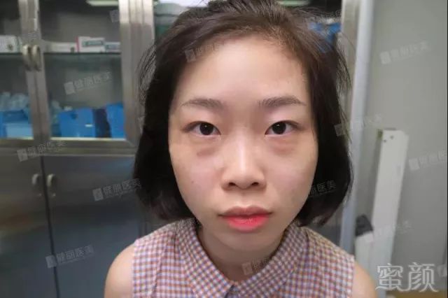 https://img.miyanlife.com/mnt/timg/180223/112K41B4-4.jpg