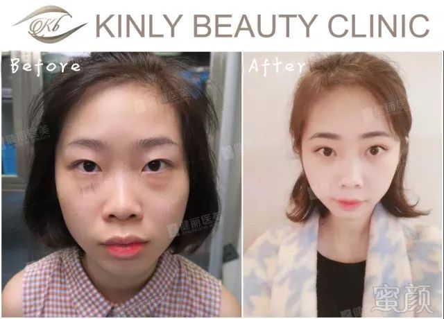 https://img.miyanlife.com/mnt/timg/180223/112K53026-8.jpg