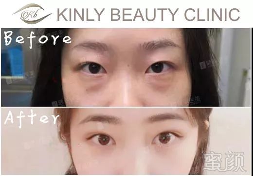 https://img.miyanlife.com/mnt/timg/180223/112K63N8-9.jpg