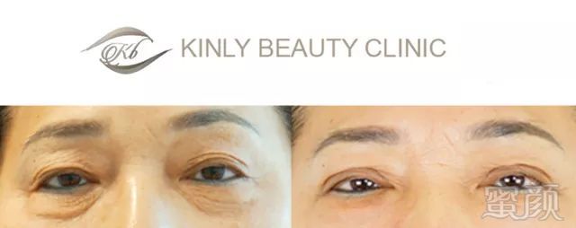 https://img.miyanlife.com/mnt/timg/180223/112KJB4-14.jpg