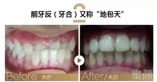 https://img.miyanlife.com/mnt/timg/180223/1135425B6-17.jpg