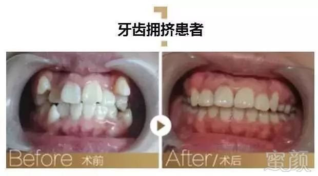 https://img.miyanlife.com/mnt/timg/180223/1135433J7-18.jpg