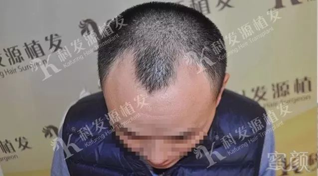 https://img.miyanlife.com/mnt/timg/180223/114443B21-0.jpg