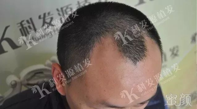 https://img.miyanlife.com/mnt/timg/180223/114443J14-1.jpg