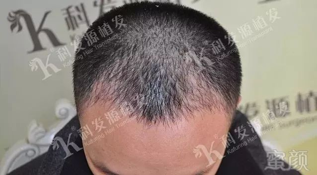 https://img.miyanlife.com/mnt/timg/180223/114444MO-5.jpg