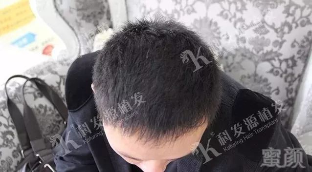 https://img.miyanlife.com/mnt/timg/180223/11444522E-7.jpg