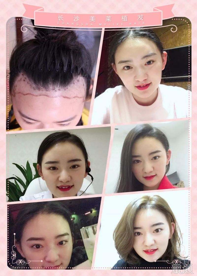 https://img.miyanlife.com/mnt/timg/180223/114P362R-3.jpg