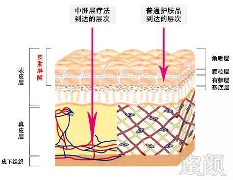 https://img.miyanlife.com/mnt/timg/180223/1150534396-0.jpg