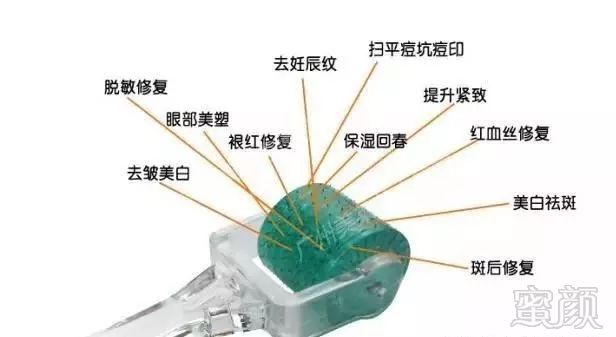 https://img.miyanlife.com/mnt/timg/180223/11505430V-1.jpg