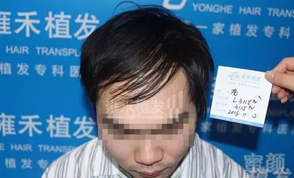 https://img.miyanlife.com/mnt/timg/180223/1200294R8-0.jpg