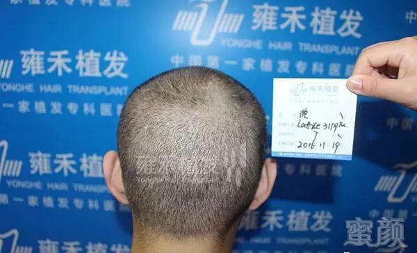 https://img.miyanlife.com/mnt/timg/180223/1200311113-7.jpg