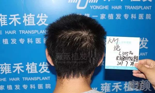 https://img.miyanlife.com/mnt/timg/180223/12003363L-13.jpg