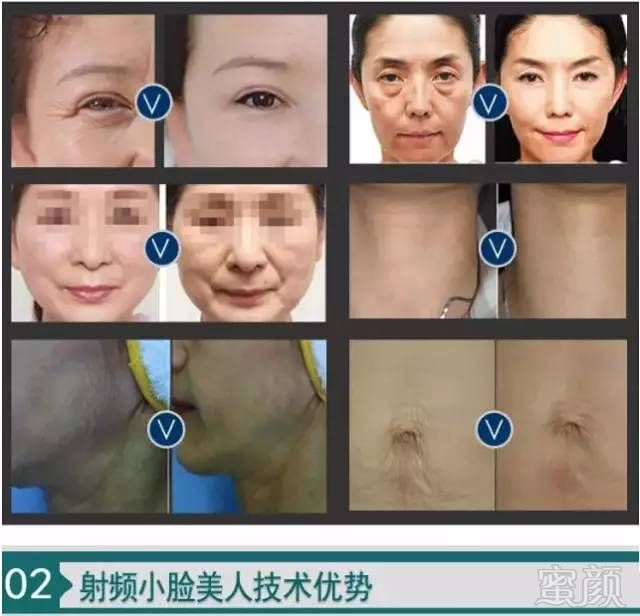 https://img.miyanlife.com/mnt/timg/180223/120254EX-2.jpg