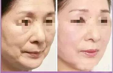 https://img.miyanlife.com/mnt/timg/180223/1202561R0-7.jpg