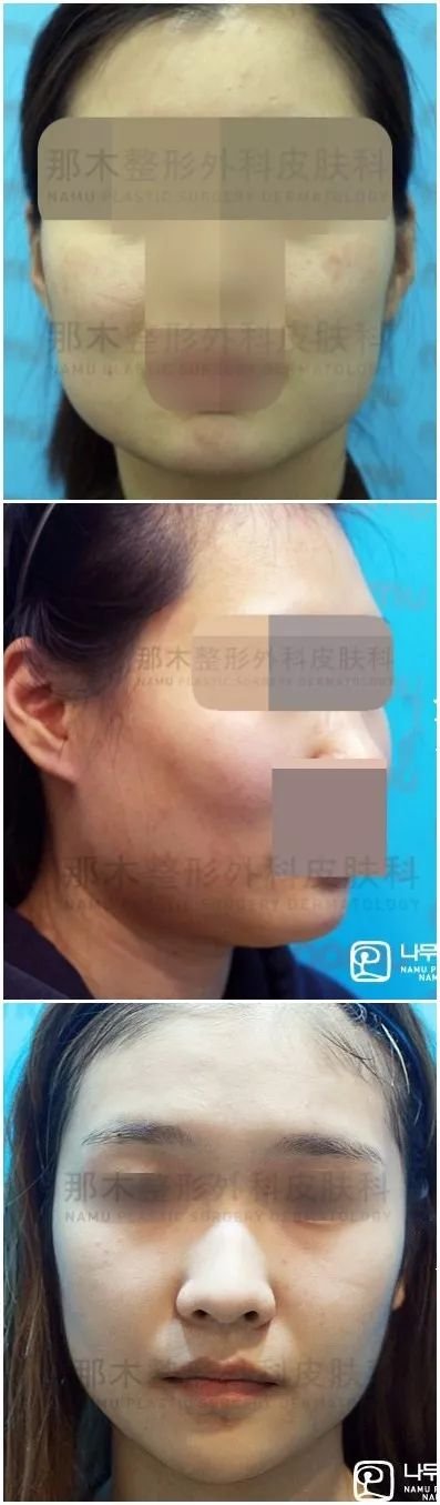 https://img.miyanlife.com/mnt/timg/180223/12531aZ8-3.jpg