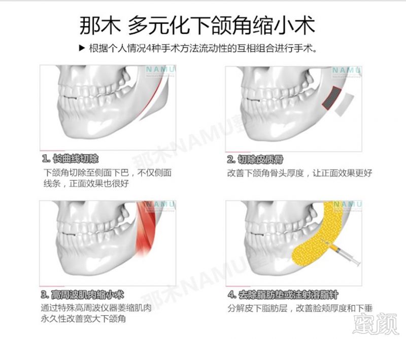 https://img.miyanlife.com/mnt/timg/180223/125320A43-5.jpg