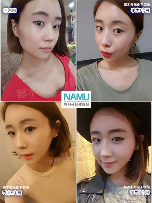https://img.miyanlife.com/mnt/timg/180223/125321IB-9.jpg