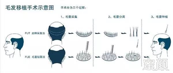 https://img.miyanlife.com/mnt/timg/180224/1036341210-3.jpg
