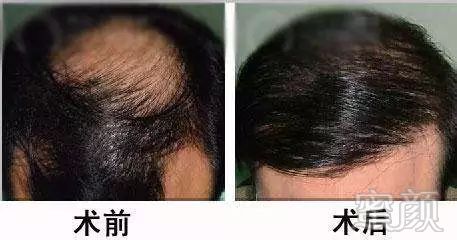 https://img.miyanlife.com/mnt/timg/180224/10363KZ6-10.jpg