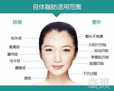 https://img.miyanlife.com/mnt/timg/180224/1050561240-1.jpg