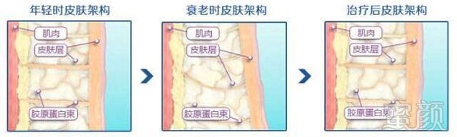 案例图片