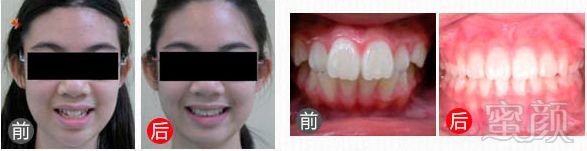 https://img.miyanlife.com/mnt/timg/180224/1103562H6-13.jpg