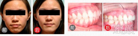 https://img.miyanlife.com/mnt/timg/180224/1103563026-12.jpg