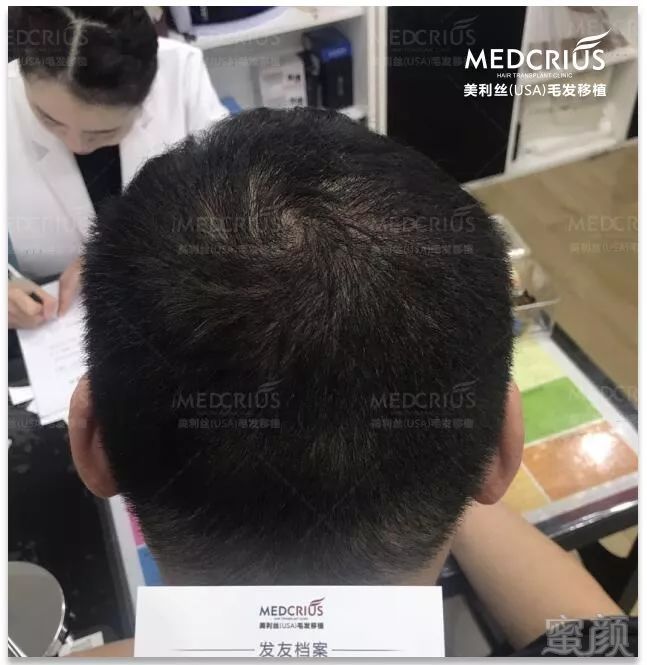 https://img.miyanlife.com/mnt/timg/180224/1104121055-2.jpg