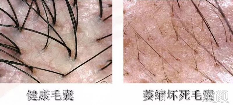 https://img.miyanlife.com/mnt/timg/180224/1104135114-3.jpg
