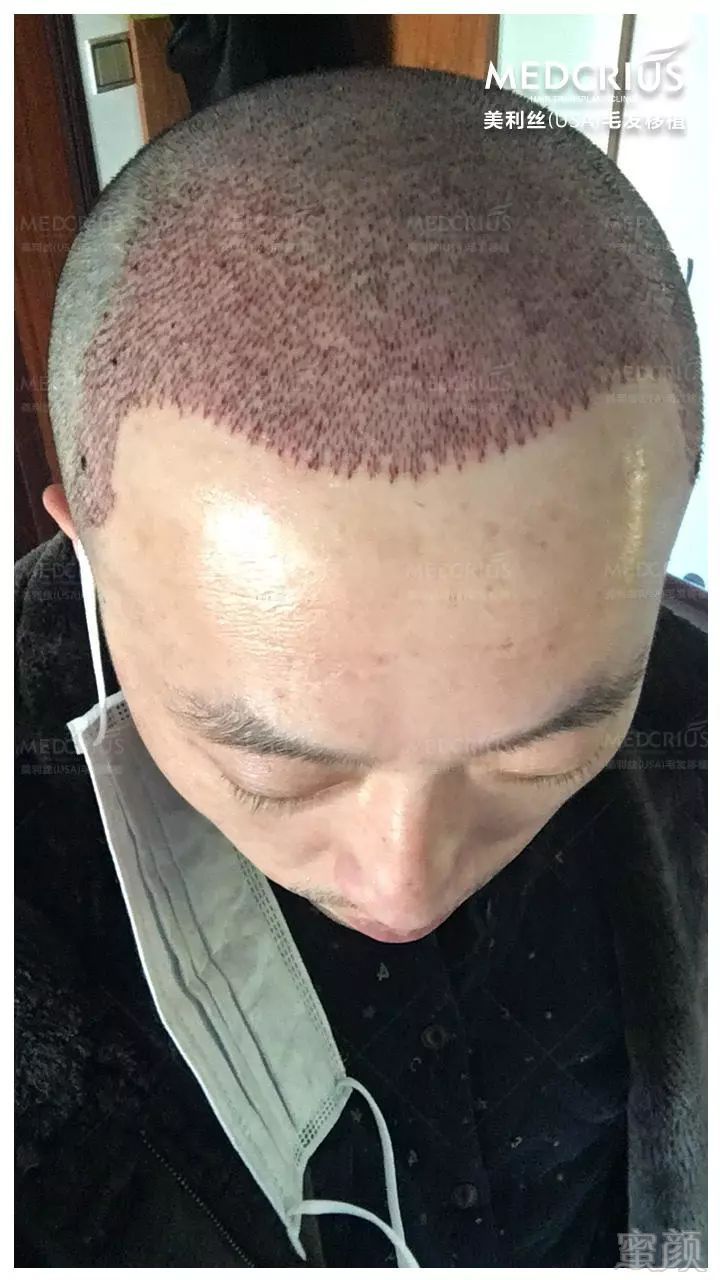 https://img.miyanlife.com/mnt/timg/180224/1104156208-11.jpg