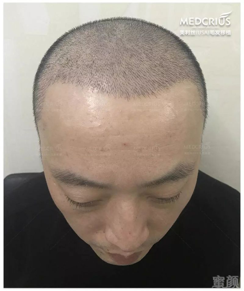 https://img.miyanlife.com/mnt/timg/180224/1104161359-12.jpg