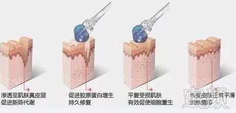 https://img.miyanlife.com/mnt/timg/180224/12031315N-5.jpg