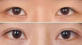 https://img.miyanlife.com/mnt/timg/180224/12221513R-2.jpg
