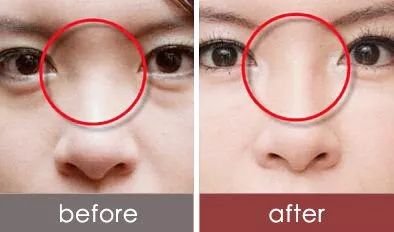 https://img.miyanlife.com/mnt/timg/180224/122RL0F-3.jpg