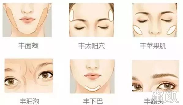 https://img.miyanlife.com/mnt/timg/180224/12302222J-10.jpg