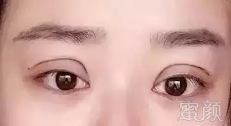 https://img.miyanlife.com/mnt/timg/180225/094Z0Ia-10.jpg