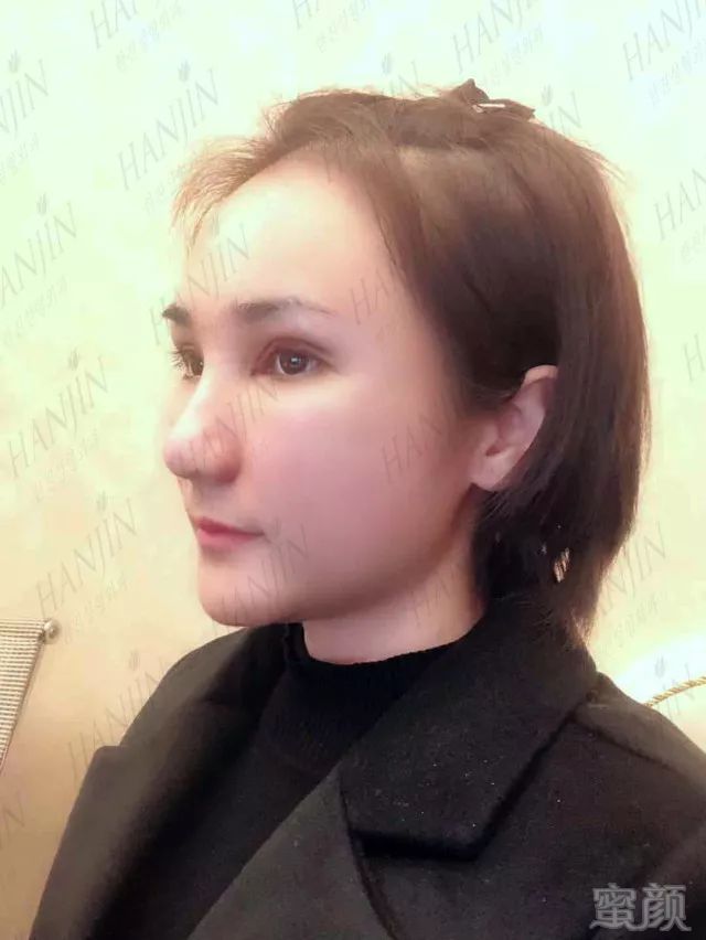 https://img.miyanlife.com/mnt/timg/180225/1001354214-12.jpg