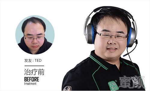 https://img.miyanlife.com/mnt/timg/180225/1010013V8-0.jpg