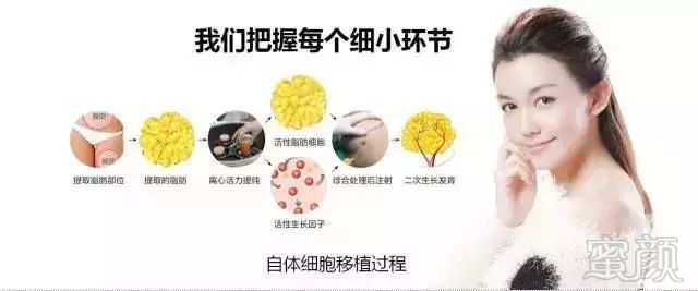 https://img.miyanlife.com/mnt/timg/180225/1011362534-6.jpg