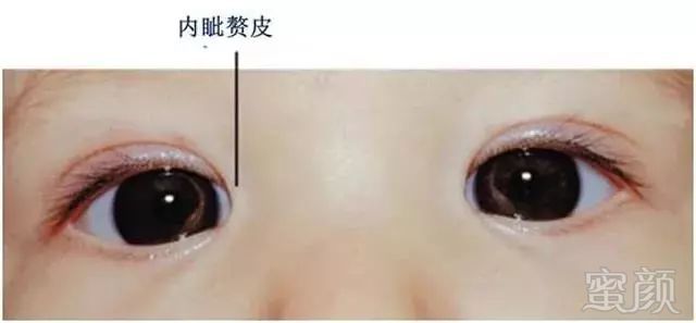 https://img.miyanlife.com/mnt/timg/180225/10140555a-5.jpg