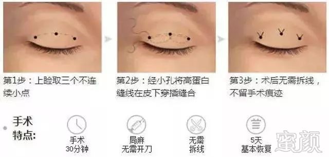 https://img.miyanlife.com/mnt/timg/180225/1014103939-9.jpg