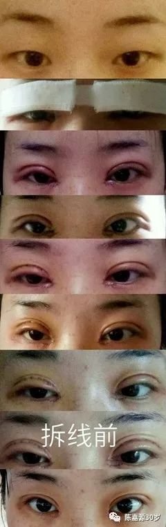 https://img.miyanlife.com/mnt/timg/180225/102302MW-0.jpg