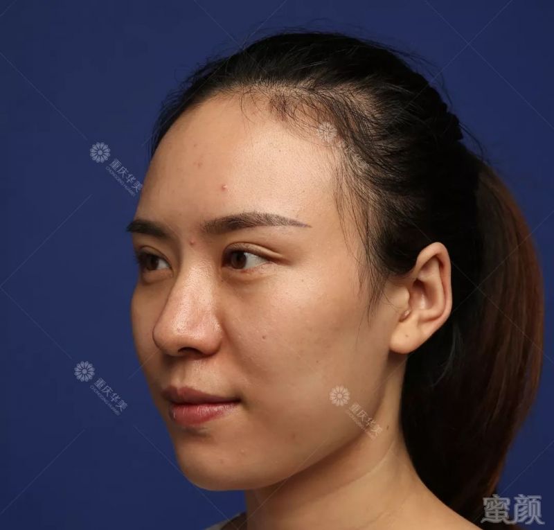 https://img.miyanlife.com/mnt/timg/180225/10353014C-1.jpg
